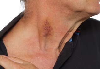 napadení policistou_Malostranské náměstí (2)