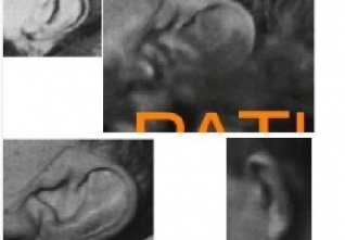 Levá ucha Jana Masaryka 