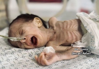 gaza hlad dite